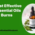 Best Effective Essential Oils for Burns