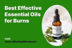 Best Effective Essential Oils for Burns