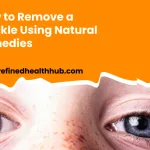 How to Remove a Freckle Using Natural Remedies