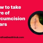 How to take care of Circumcision Scars