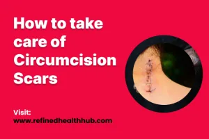 How to take care of Circumcision Scars