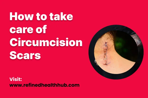 How to take care of Circumcision Scars: Their Causes, Types, and Treatment.